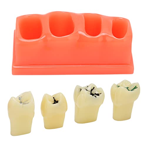 Натудеко модел на заби Модел на расипување на забите Модел на протеза Модел Флексибилно ја расклопува чистата структура, силна, издржлива