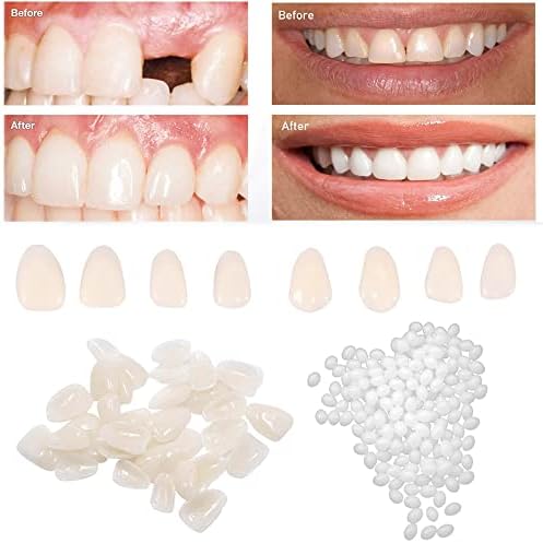 Комплет за поправка на забите-термички монистра гранули и лажни заби за привремено поправање на исчезнати и скршен заб