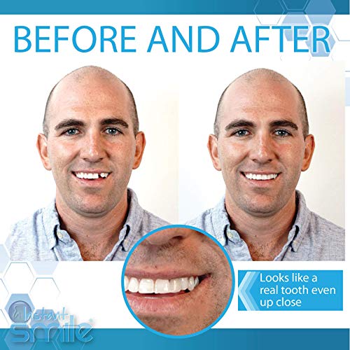 Инстант насмевка Пополнете ја комплетот за замена на забите со насмевка со 3 монистра што одговараат на пакувања