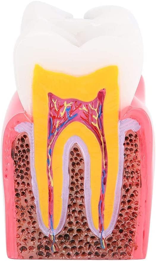 Модел на заби во Шенганг, модели на студии за споредба на кариес, модел на заби за заби на стоматолошка анатомија, за стоматолошки
