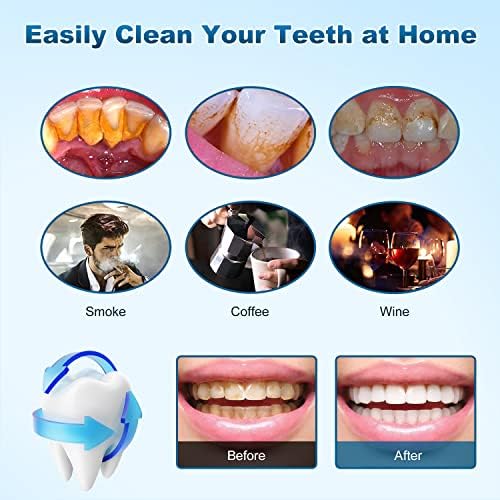 Комплет за чистење на забите, алатка за чистење на електрична заби со LED светло, средство за чистење на заби со 3 режими, средство за