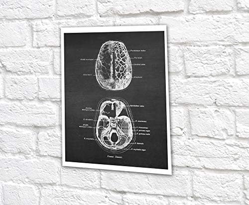 Архива на гноза Архива на невронски мрежи сет од 6 нерасположени отпечатоци на човечка анатомија на мозокот