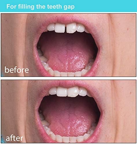 Комплет за поправка на привремено заби за пополнување на исчезнати скршени заби и празнини со лажни заби и комплет за замена на термички